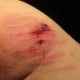 Cane marks by Dominatrix Mistress Troy, New York City