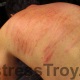 Fresh welts in Mistress Troy's New York City dungeon